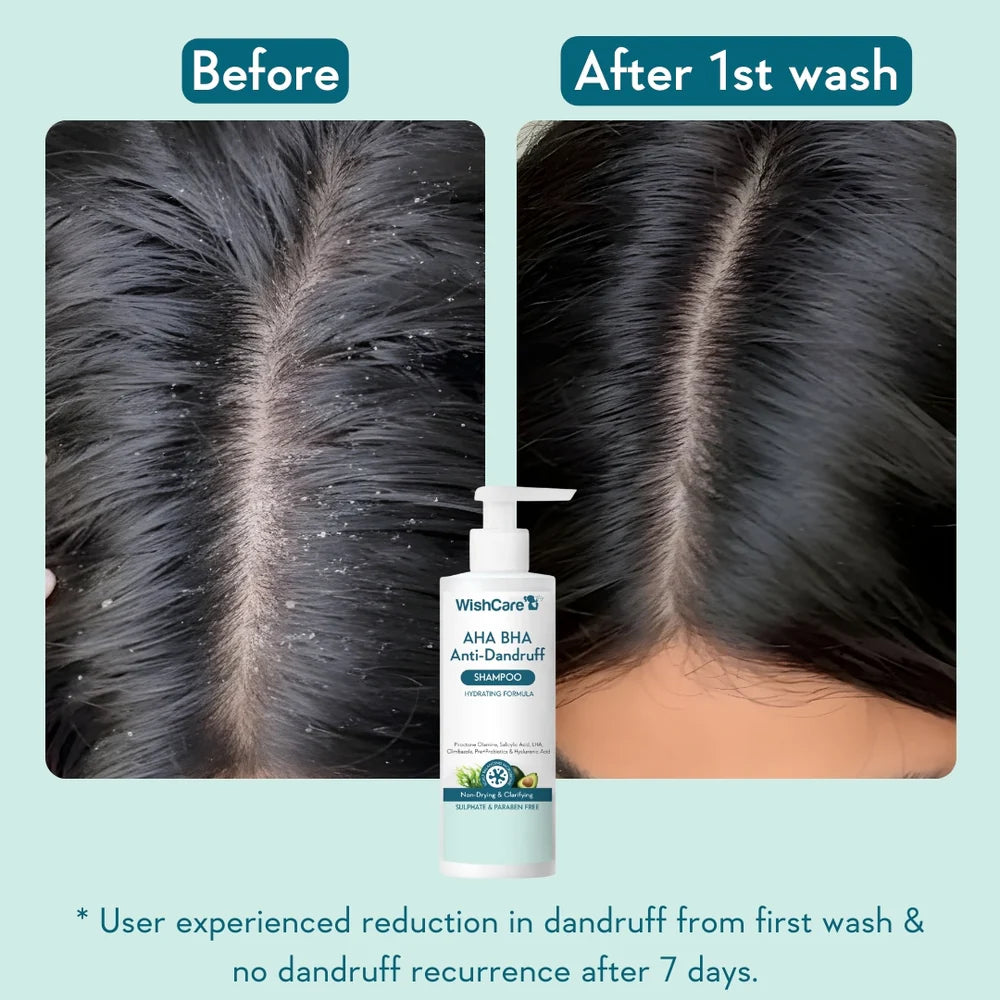 WishCare AHA BHA Anti-Dandruff Shampoo - photo 4