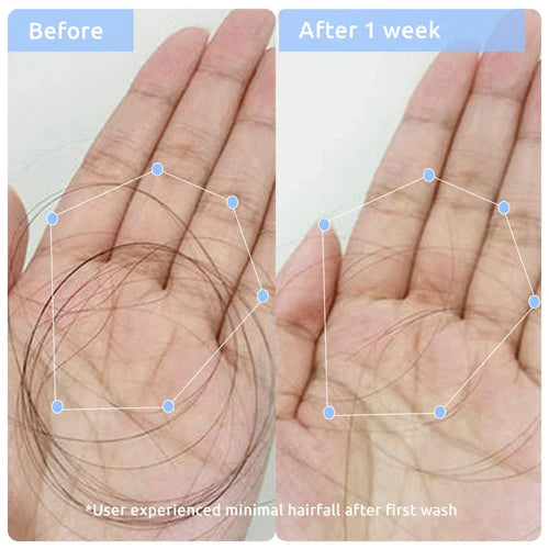 Wishcare Multi Peptide Anti Hairfall Duo - photo 4
